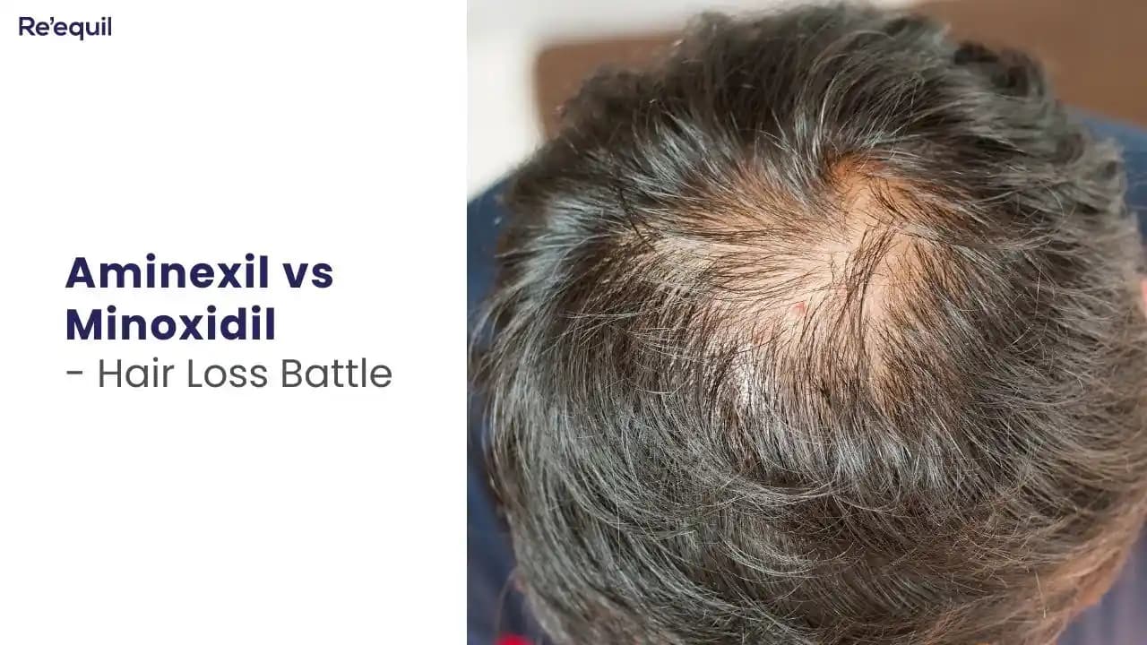 Aminexil ve Minoxidil: Saç Dökülmesini Önlemede Etkili İki Farklı Çözüm