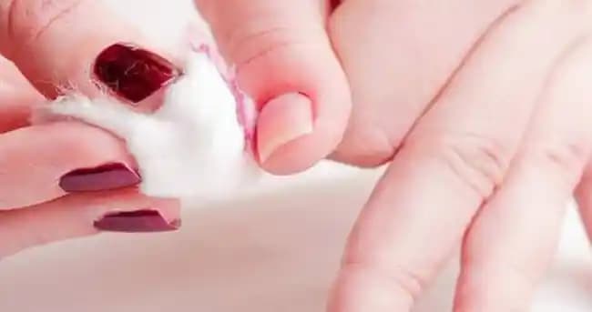 Asetonsuz Oje Nasıl Silinir: Doğal ve Etkili Tırnak Temizleme Yöntemleri