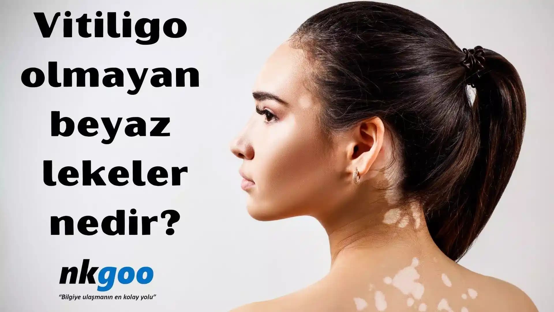 Bebeklerde Vitiligo Olmayan Beyaz Lekeler: Nedenleri, Tanısı ve Bakım Önerileri