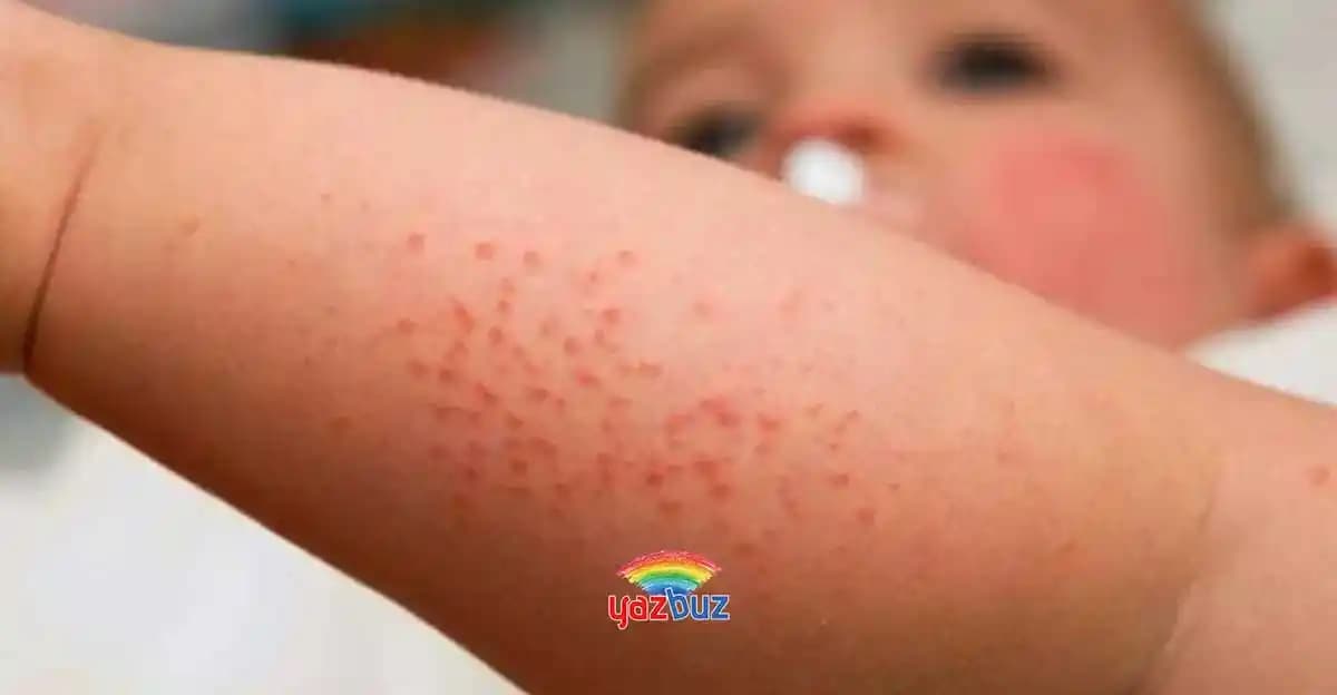 Bebeklerde Vücutta Kırmızı Lekeler: Nedenleri, Belirtileri ve Etkili Bakım Önerileri