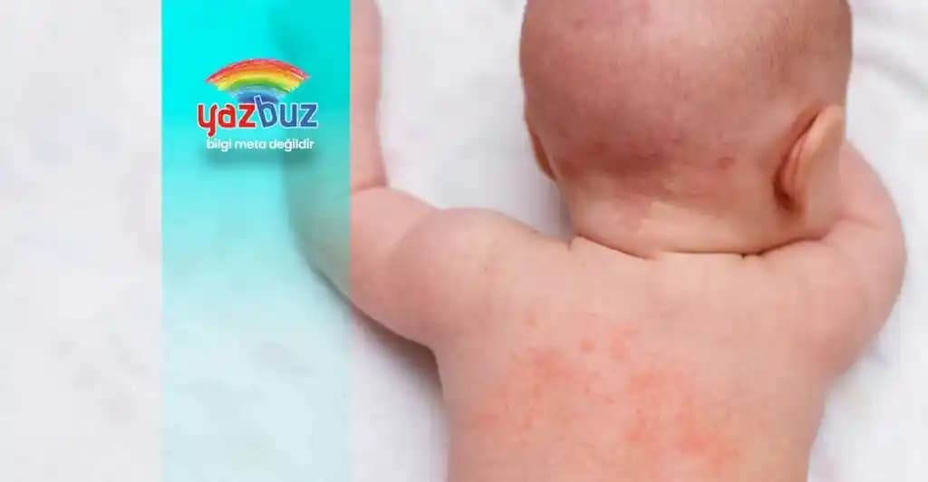 Bebeklerde Yüzde Kırmızı Lekeler: Nedenler, Belirtiler ve Etkili Bakım Yöntemleri