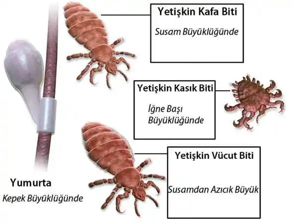 Bit Yumurtası Nedir? Saçta Bit Yumurtalarının Görünümü ve Etkili Tedavi Yöntemleri