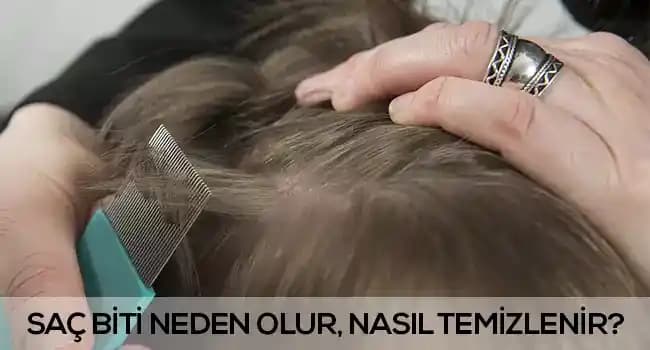 Boyalı Saçta Bit Oluşumu ve Korunma Yöntemleri Hakkında Kapsamlı Rehber