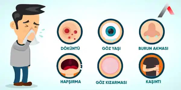 Boyunda Alerji Nedenleri, Belirtileri ve Etkili Korunma Yöntemleri