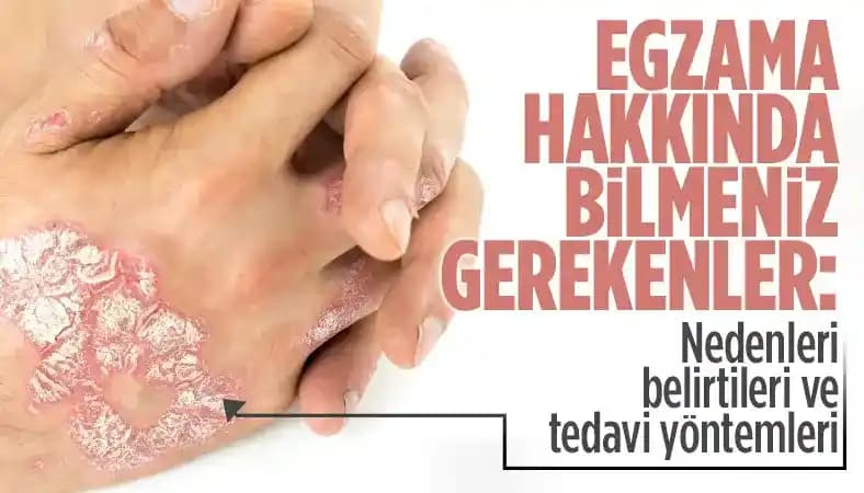 Boyundaki Egzama: Belirtiler, Nedenler ve Etkili Bakım Yöntemleri Hakkında Rehber