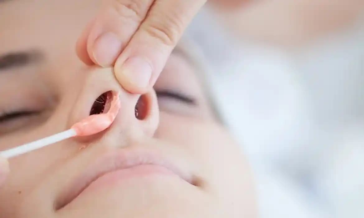 Burun Ucunda Yara: Nedenleri, Tedavi Yöntemleri ve Kozmetik Bakım Önerileri