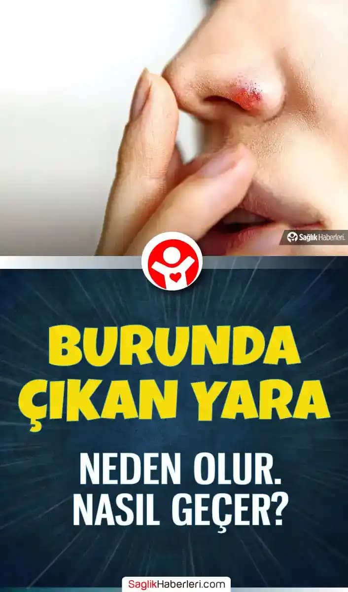 Burunda Yara Nedenleri, Belirtileri ve Tedavi Yöntemleri: Kapsamlı Rehber