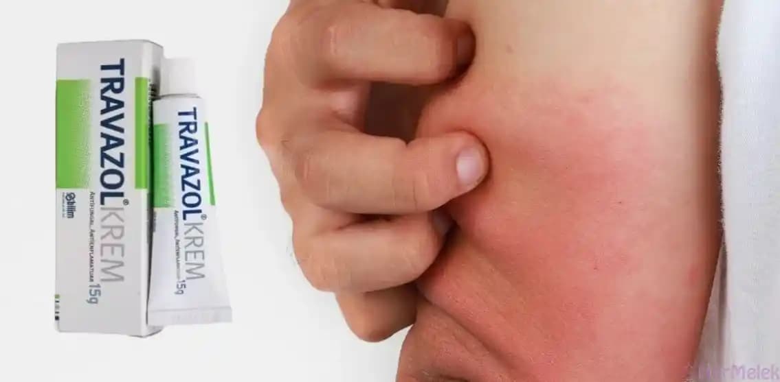 Cilt Alerji Kremleri: Etkili Koruma ve Doğru Ürün Seçimi Rehberi