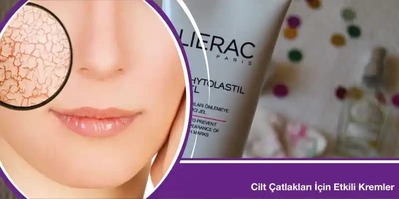 Cilt Çatlaklarını Önlemek İçin Etkili Yöntemler ve Doğru Bakım Önerileri