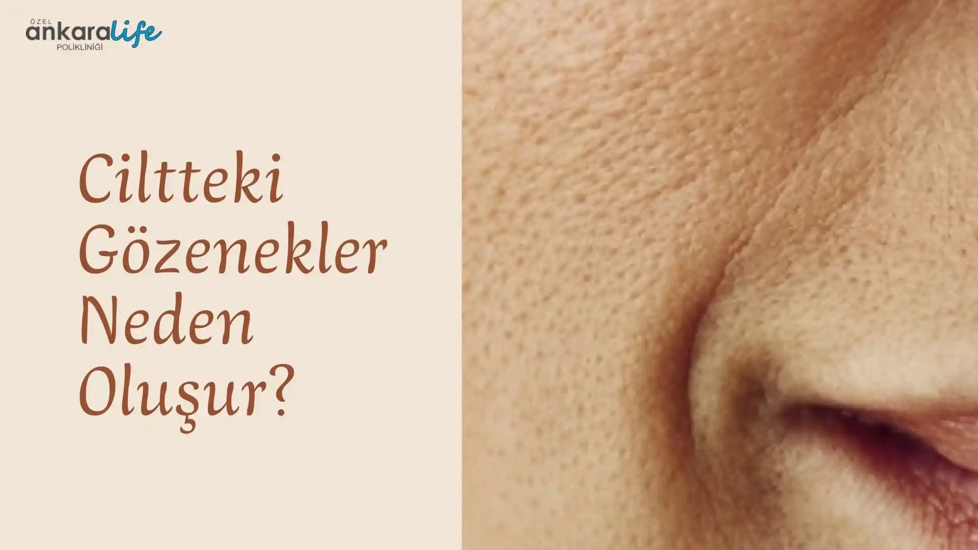 Cilt Gözenekleri Neden Genişler ve Görünümü Nasıl Azaltılır? Detaylı İnceleme