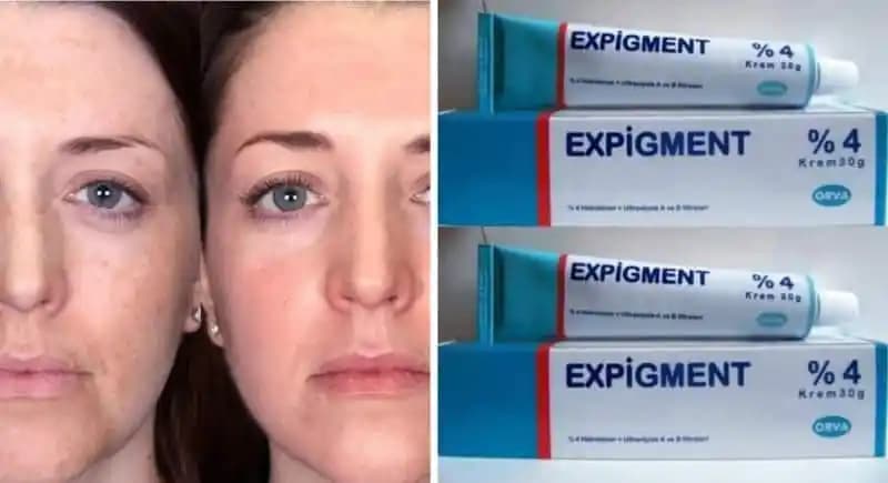 Cilt Lekeleri İçin Etkili Krem Seçimi ve Doğru Kullanım Rehberi