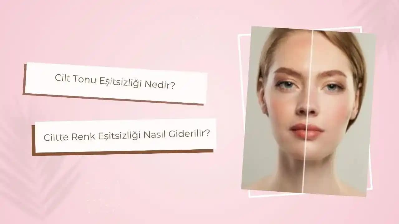Ciltte Renk Eşitsizliği Nedenleri, Önleme Yöntemleri ve Etkili Çözümler