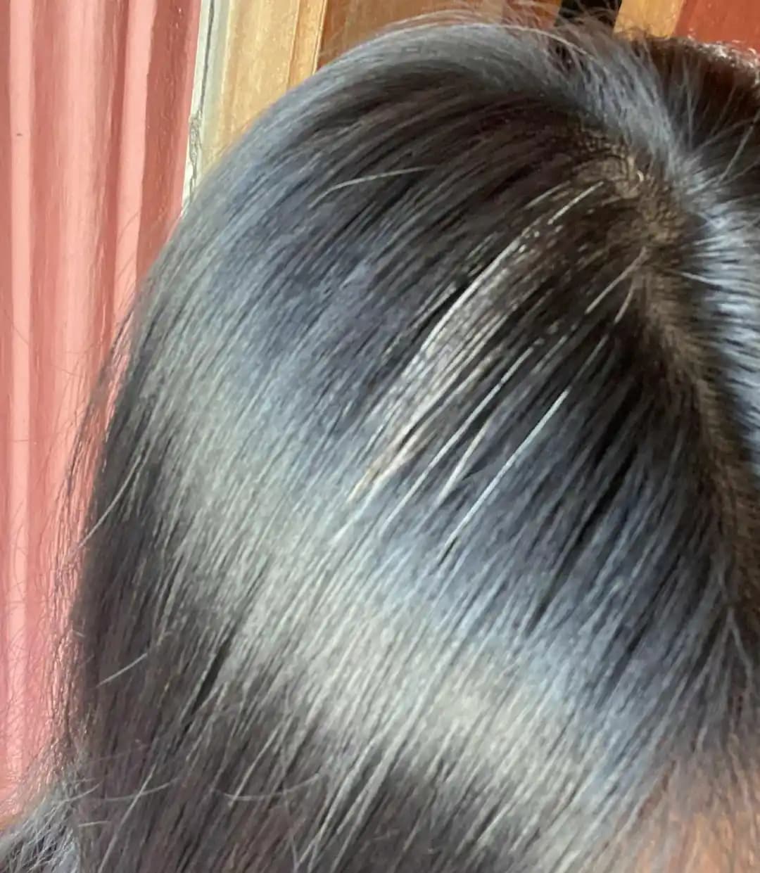 22 Yaşında Beyaz Saçların Erken Görülme Nedenleri ve Genetik Etkiler