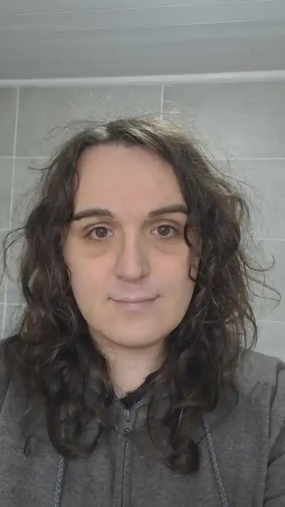 35 Yaşında Göz Altı Bakımı: Genetik ve Yaşam Tarzının Göz Altı Morluklarına Etkisi