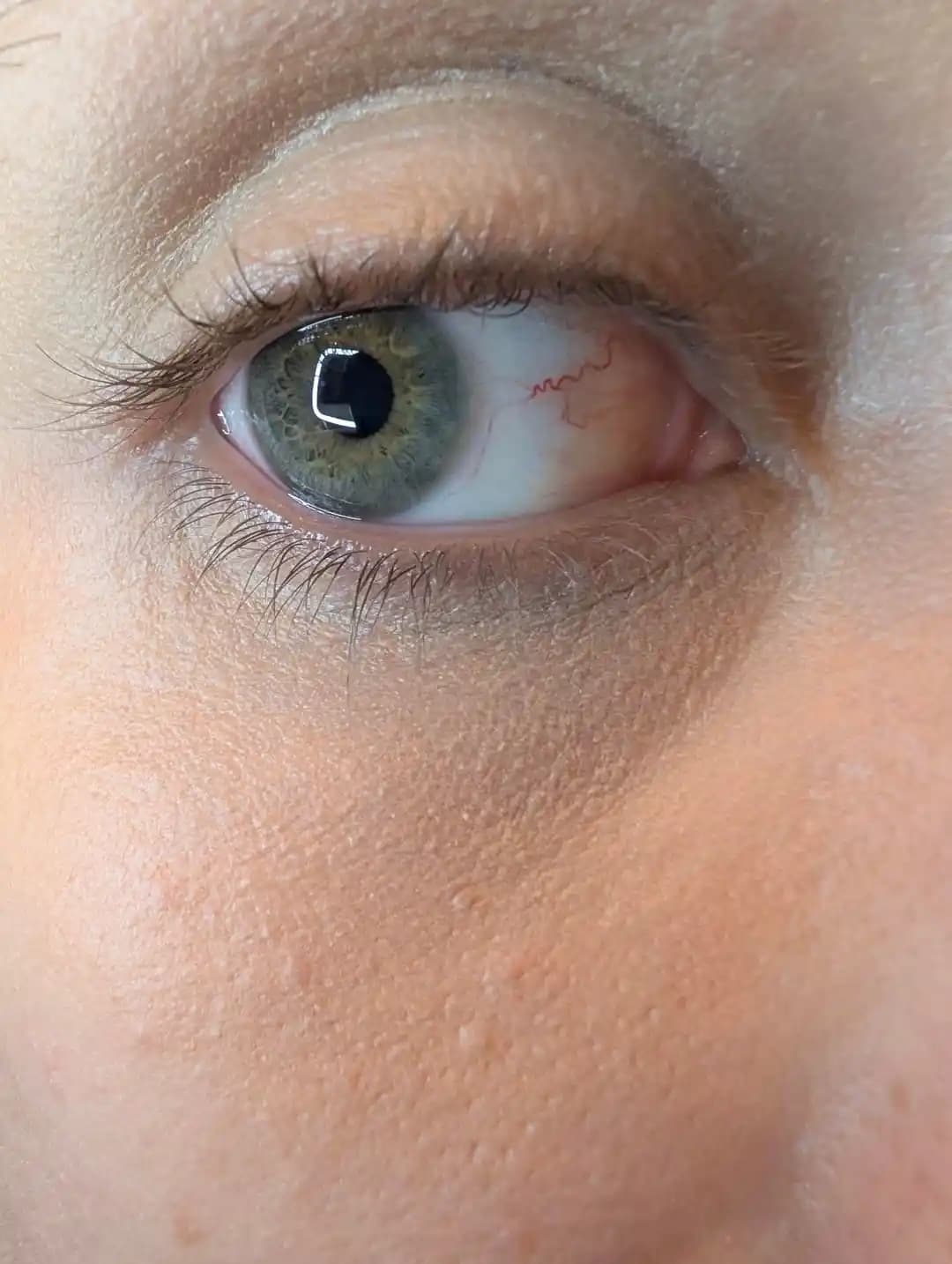 Göz Altı Dokusu: Nedenleri, Cilt Bakımı ve Makyajda Dikkat Edilmesi Gerekenler