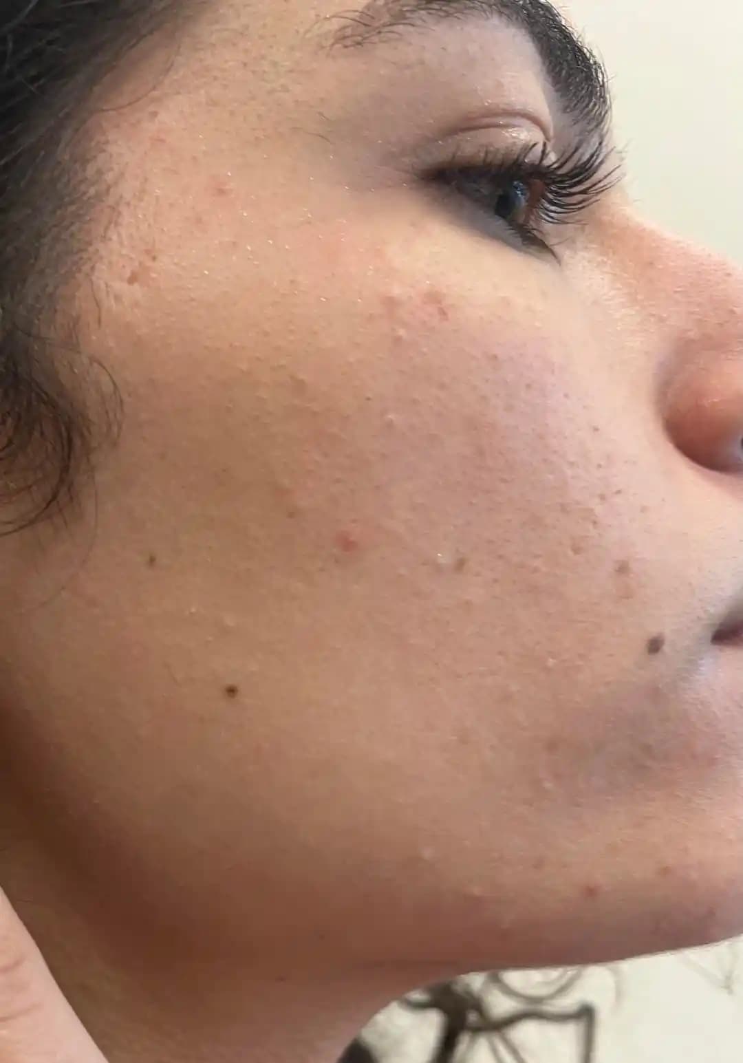 Tıkalı Gözenekler ve Kuru Cilt İçin Nazik ve Etkili Cilt Bakım Rutini Oluşturma Yöntemleri