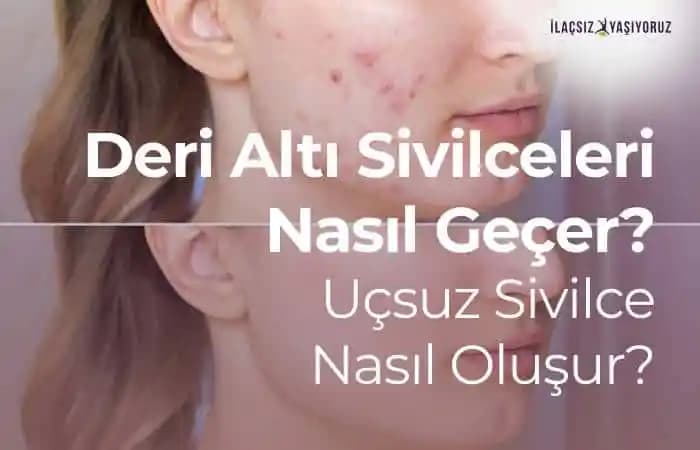 Deri Altı Sivilce Nedir ve Nasıl Geçer? Etkili Tedavi ve Bakım Yöntemleri
