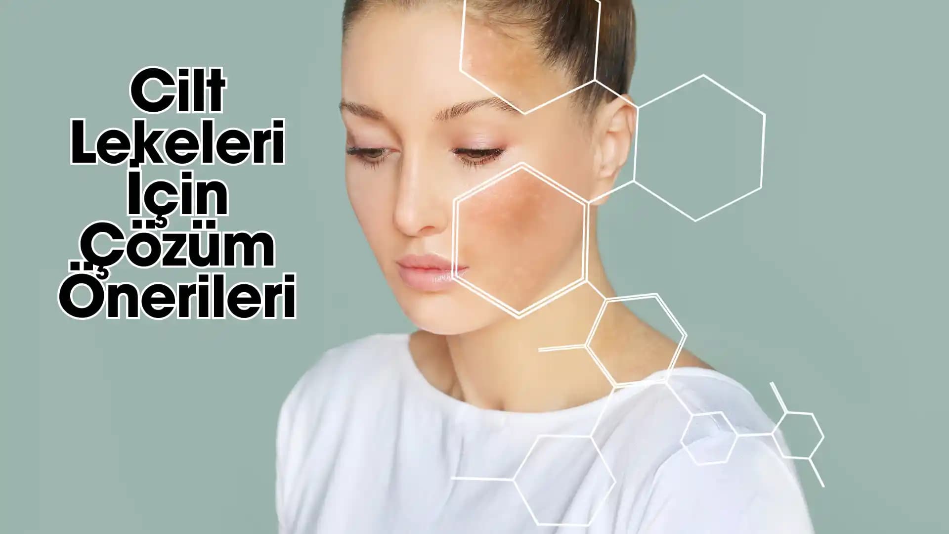 Derin Cilt Lekelerine Kesin Çözüm Yöntemleri: Profesyonel Tedaviler ve Ev Bakımı