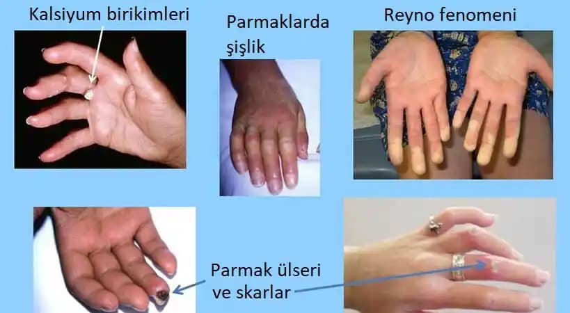 Derma Nedir? Cilt Katmanları ve Derma'nın Cilt Bakımındaki Rolü Hakkında Bilgi