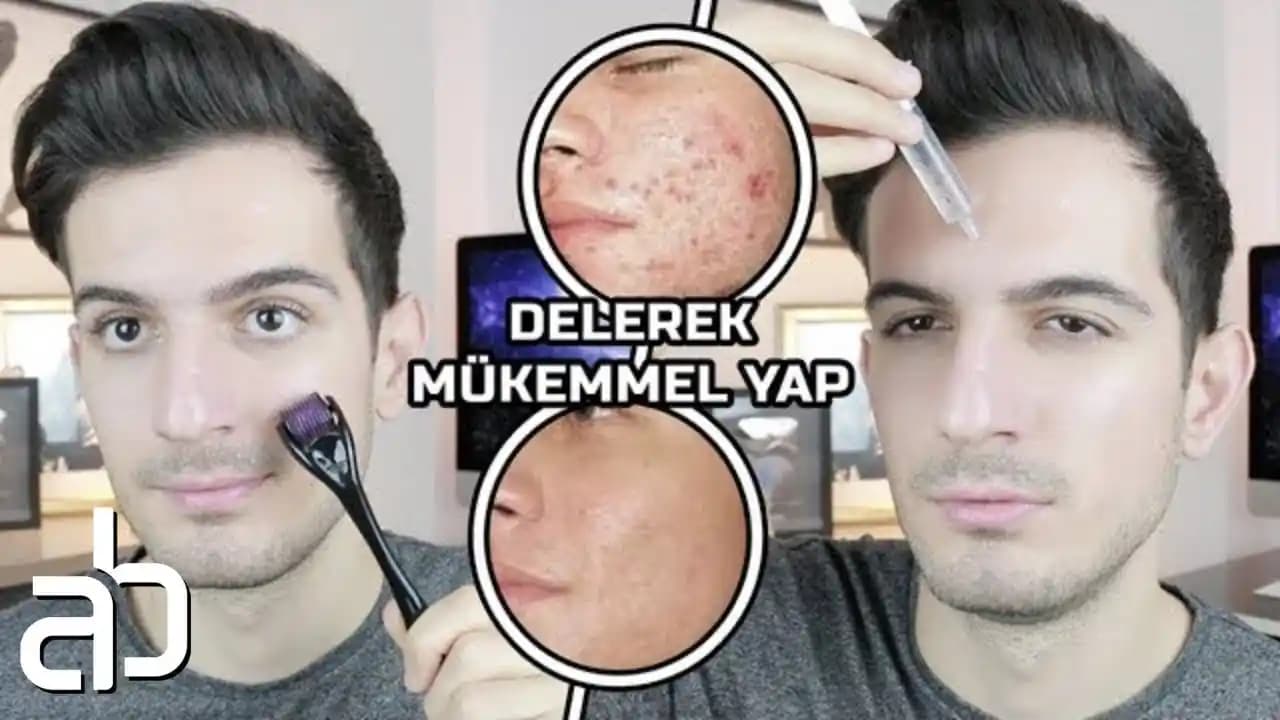 Dermaroller Kullanımı: Cilt Yenileme ve Gençleştirmede Etkili Yöntemler ve Öncesi Sonrası Değişimler