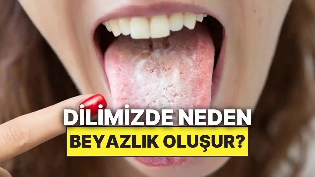 Dil Beyazlaşmasının Nedenleri ve Güzellik Açısından Kişisel Bakım Önerileri