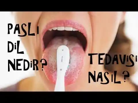 Dil Pası Nedir ve Nasıl Geçer? Etkili Yöntemler ve Korunma Önerileri
