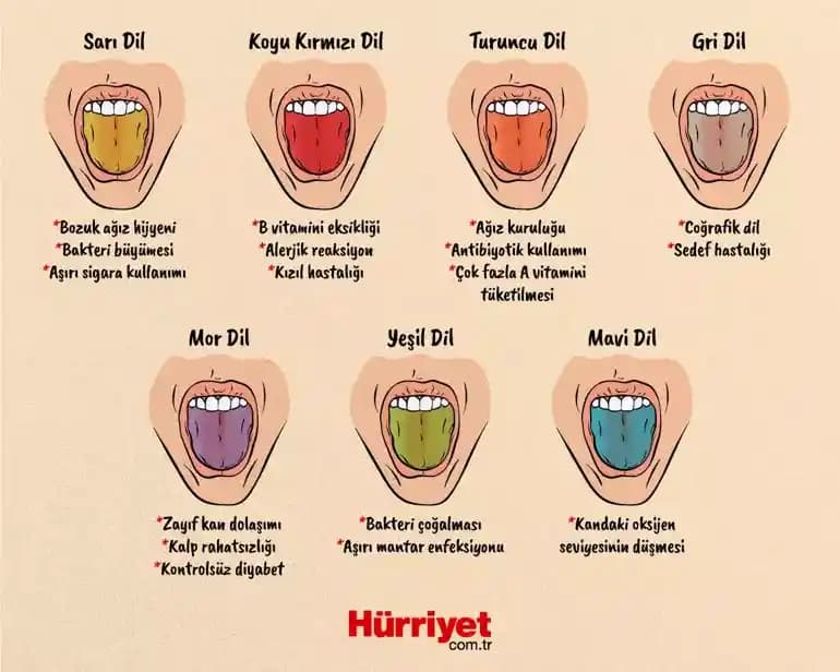 Dil Üzerinde Kırmızı Noktaların Nedenleri, Bakımı ve Önleyici Yöntemler