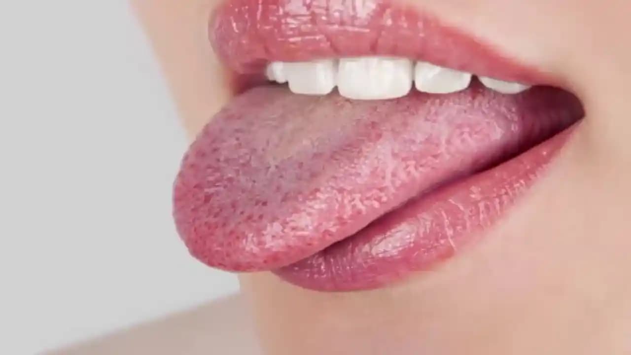 Dilde Çatlakların Nedenleri, Belirtileri ve Etkili Tedavi Yöntemleri