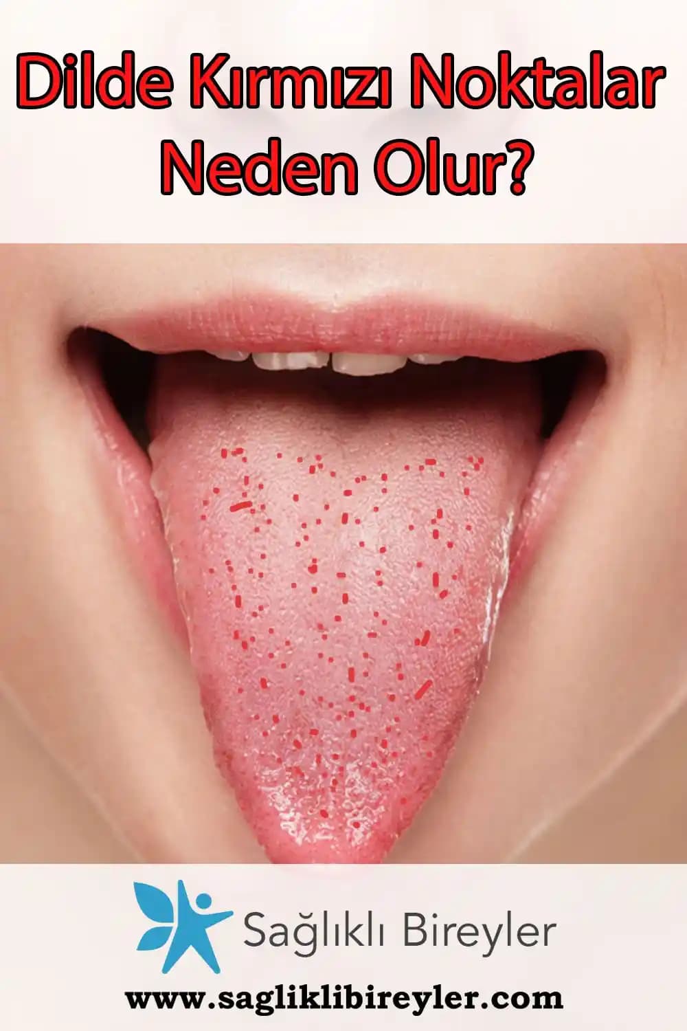 Dilde Kırmızı Lekeler: Nedenleri, Belirtileri ve Etkili Bakım Önerileri