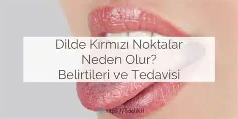Dilde Kırmızı Noktaların Nedenleri, Belirtileri ve Etkili Bakım Yöntemleri