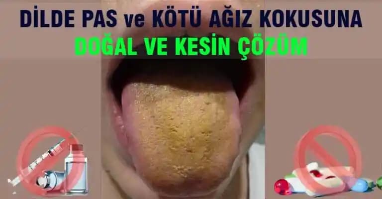 Dilde Pas Nedir? Nedenleri, Belirtileri ve Etkili Doğal Çözümler
