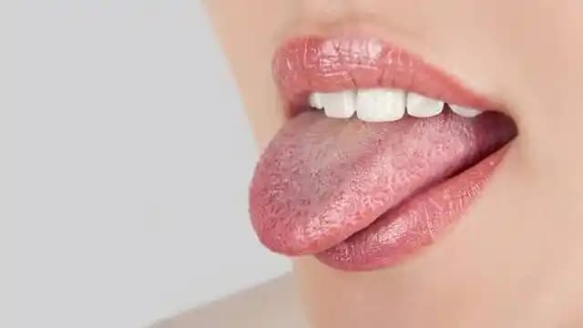 Dildeki Çatlakların Nedenleri, İyileşme Yöntemleri ve Bakım Önerileri