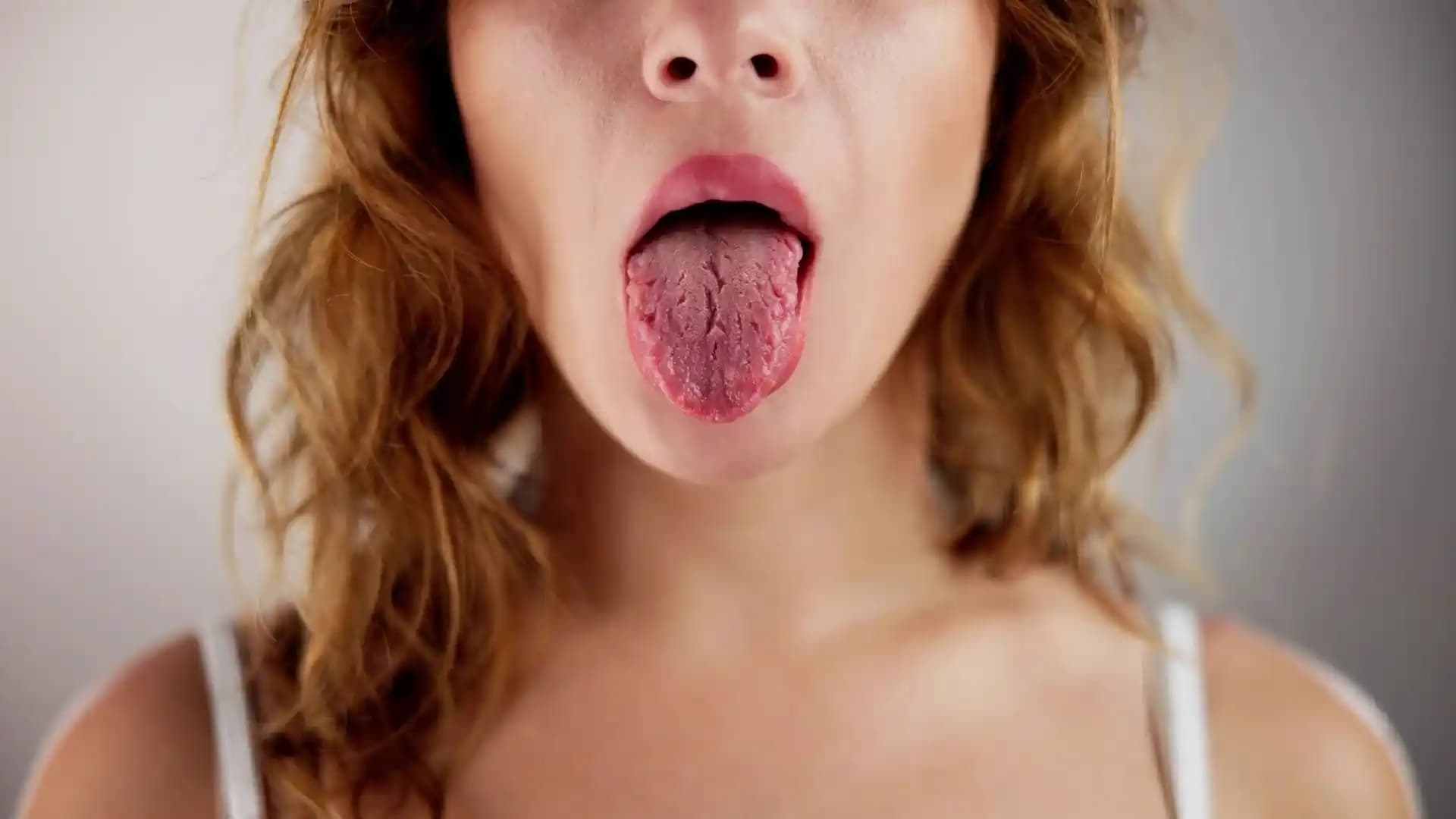 Dildeki Çatlakların Nedenleri, Tedavi Yöntemleri ve Doğal Çözümler Rehberi