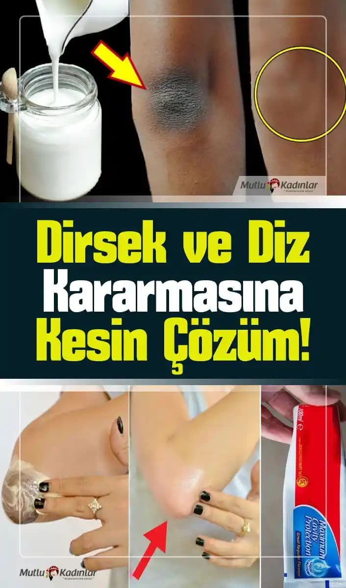 Dirsek Kararması Nedenleri, Önleme Yöntemleri ve Etkili Tedavi Seçenekleri