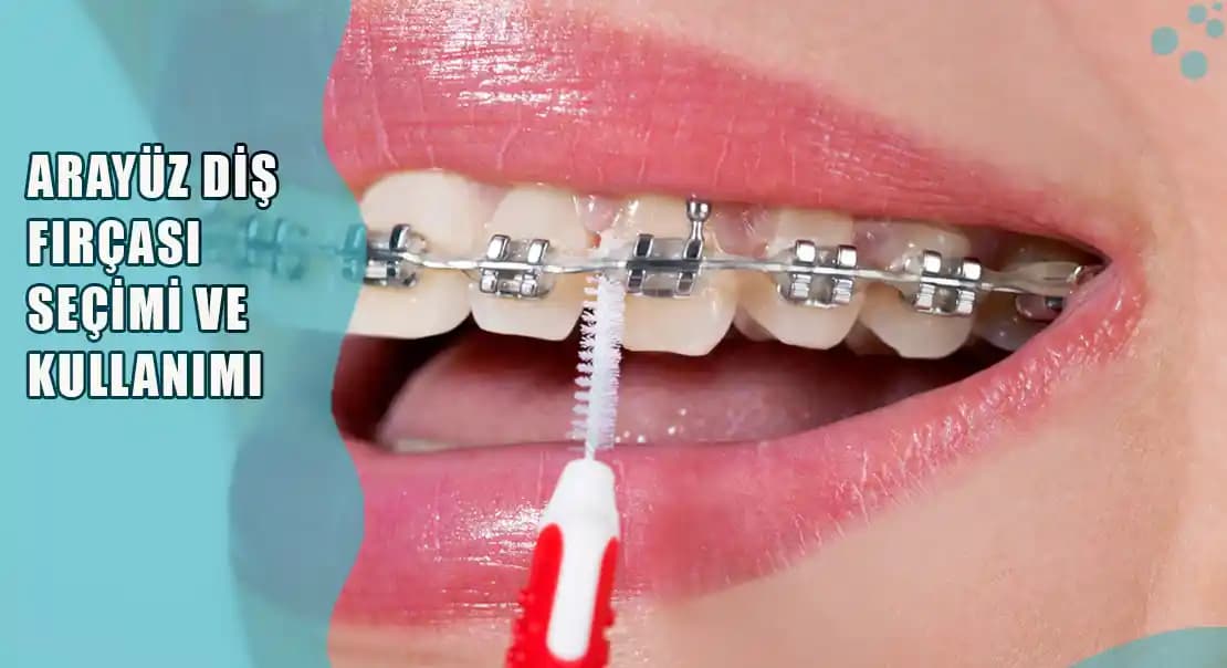 Diş Arası Fırçası Nasıl Kullanılır? Etkili Ağız Bakımı İçin Doğru Rehber