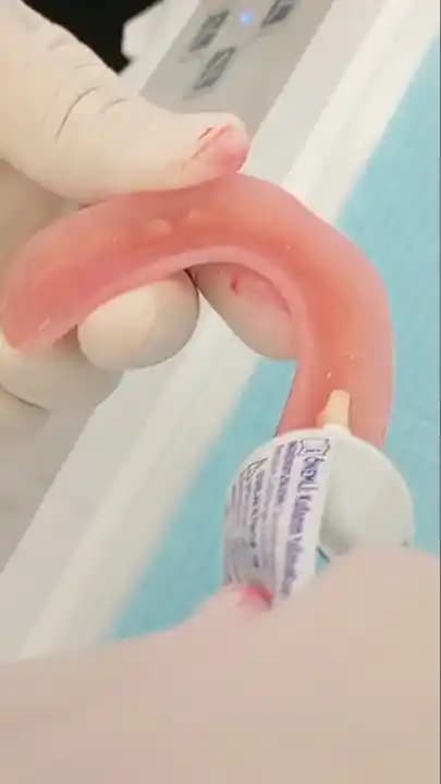 Diş Yapıştırıcıları: Türleri, Kullanımı ve Doğru Uygulama Rehberi