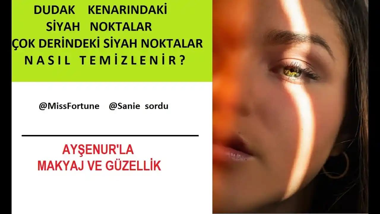 Dudak Kenarındaki Siyah Noktalar: Nedenleri, Bakım Yöntemleri ve Etkili Tedaviler