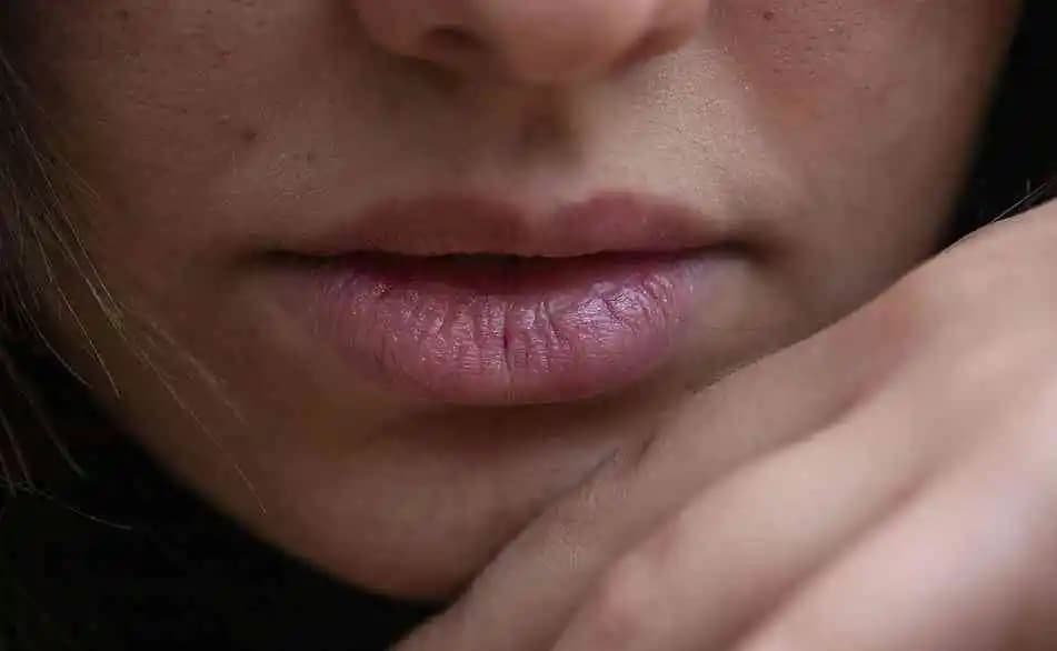 Dudak Patlaması: Nedenleri, Belirtileri ve Etkili Bakım Önerileri