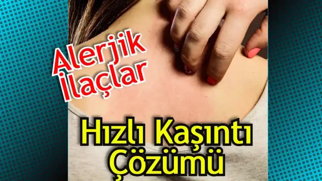 Eczanede Satılan Kaşıntı İlaçları ve Etkili Kullanım Yöntemleri Hakkında Bilgi