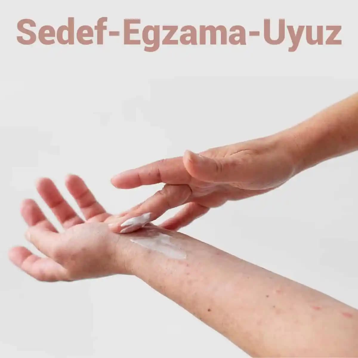 Egzama Merhemi: Cilt Sağlığını Korumak ve Egzama Semptomlarını Hafifletmek İçin Etkili Çözümler