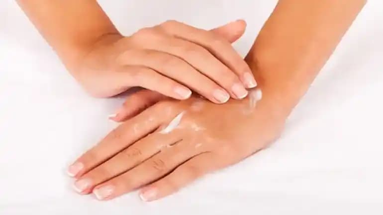 El Çatlakları İçin Etkili Bakım ve Doğal Çözümler: Nedenler ve Tedavi Yöntemleri