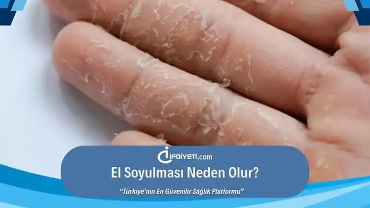El İçi Soyulması Nedenleri ve Etkili Çözüm Yolları: Kapsamlı Rehber