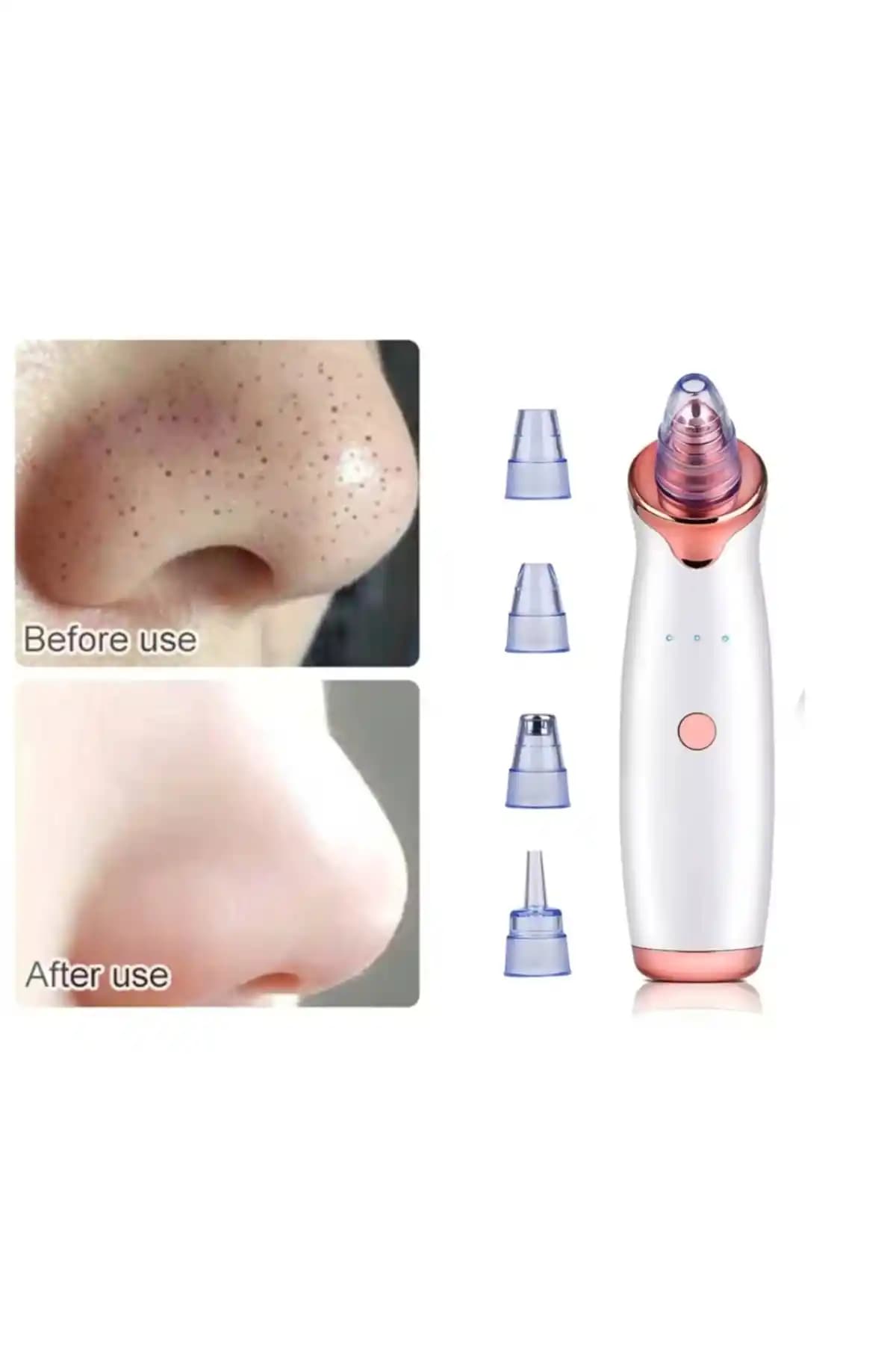 Dermasuction Şarjlı Derma Suction ile Derinlemesine Yüz Temizliği ve Gözenek Sıkılaştırma