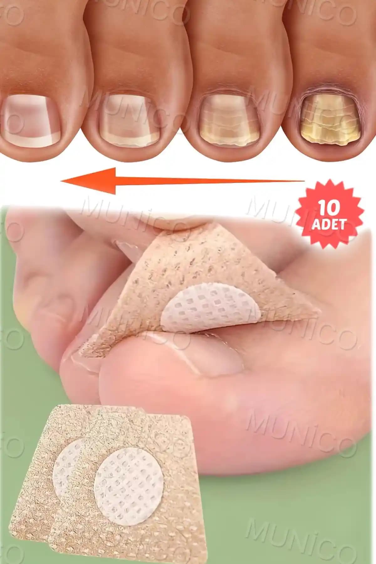 Munico 10 Çift Mantar Tırnak Yaması: Etkili ve Pratik Mantar Tedavi Çözümü