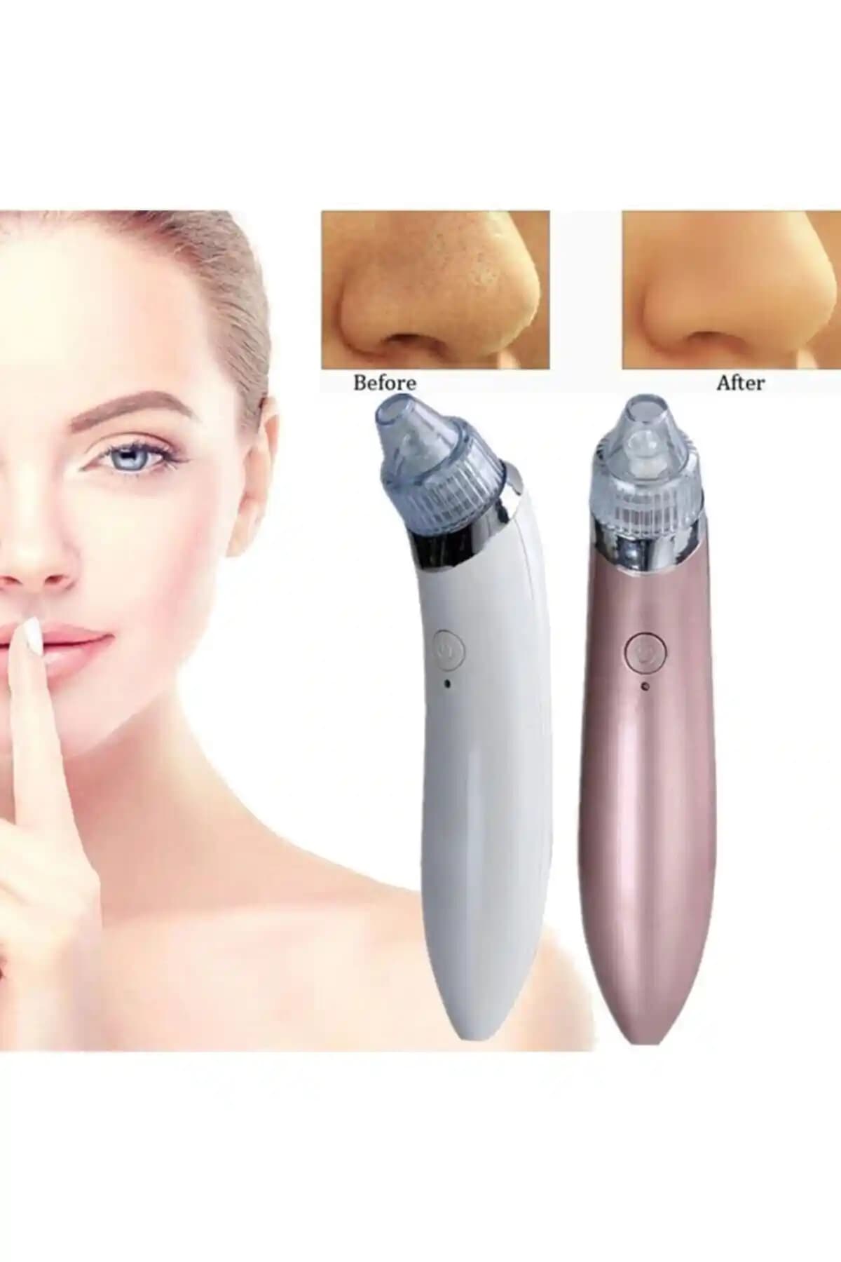 Satfinder Vakumlu Siyah Nokta Akne Temizleme Cihazı Türkiye Üretimi Güçlü ve Kullanışlı