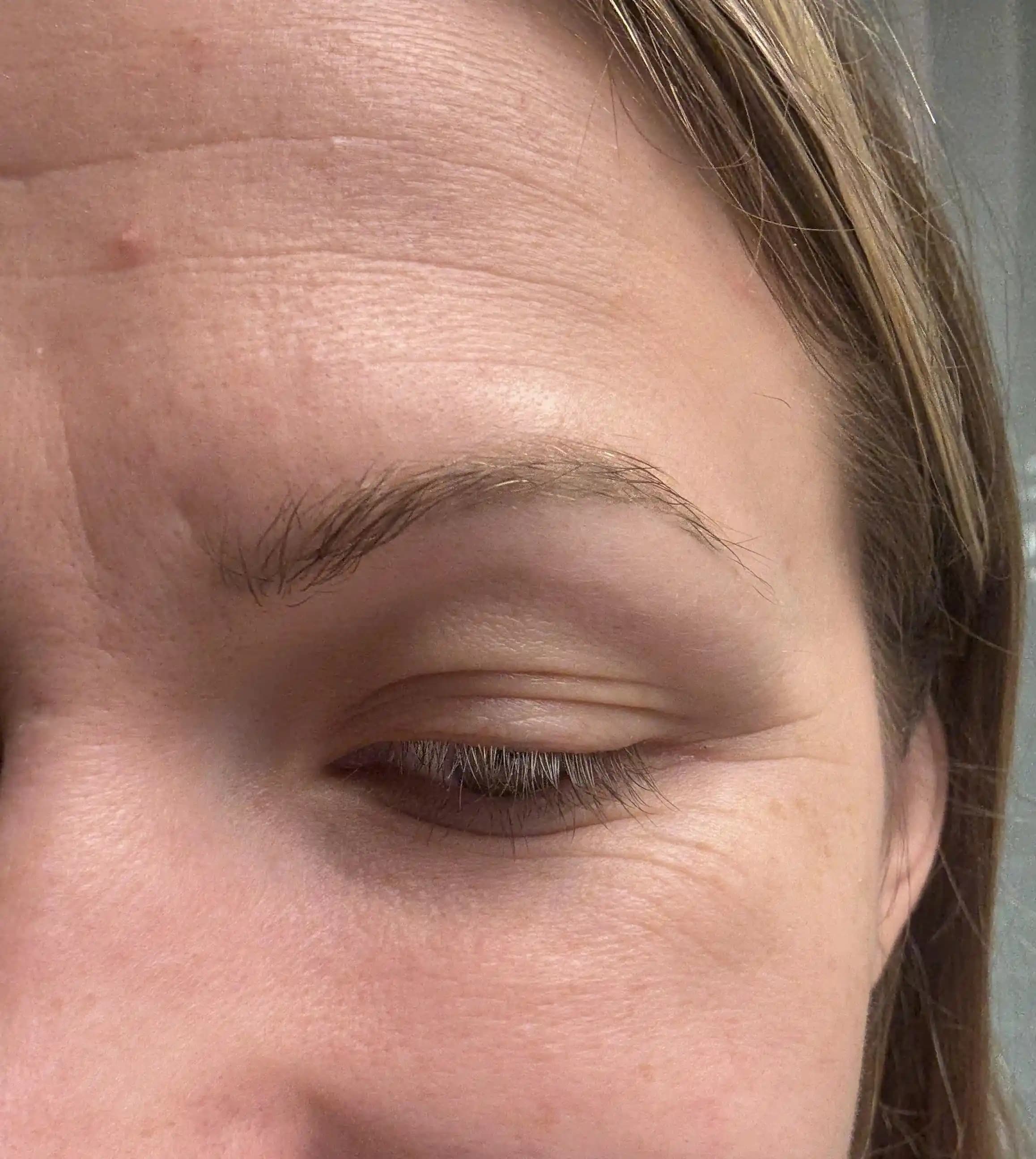 32 Yaşında Kırışıklıklarla Mücadele: Etkili Cilt Bakım Yöntemleri ve Öneriler