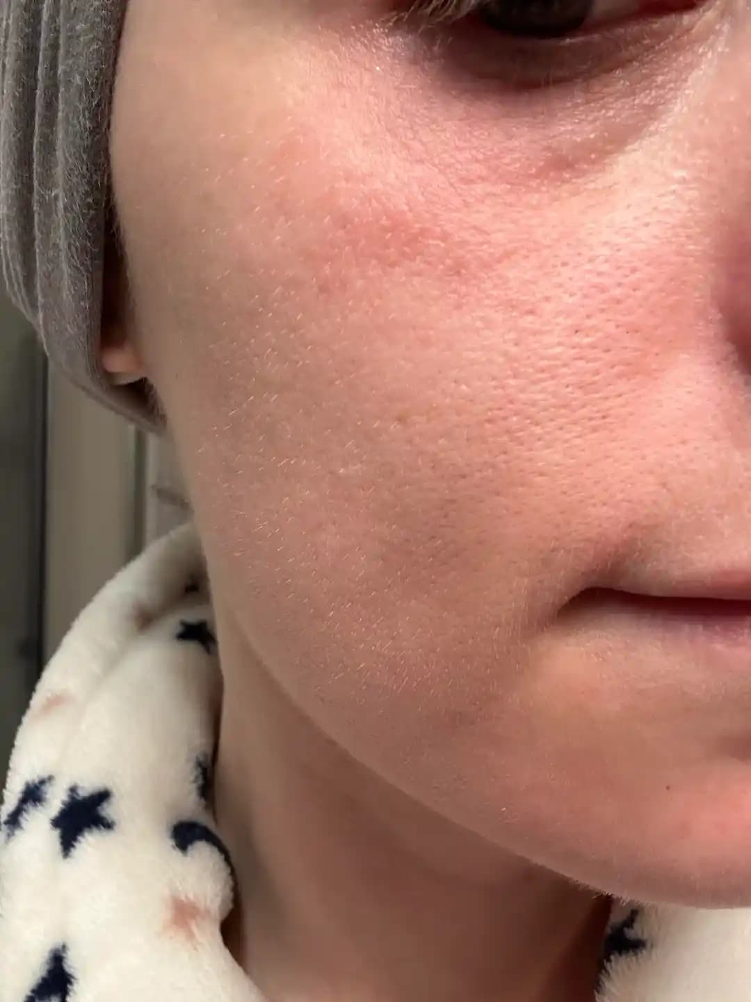 33 Yaşında Cilt Bakımı: Nemlendirme, Güneş Koruması ve Doğru Aktif İçerik Kullanımı