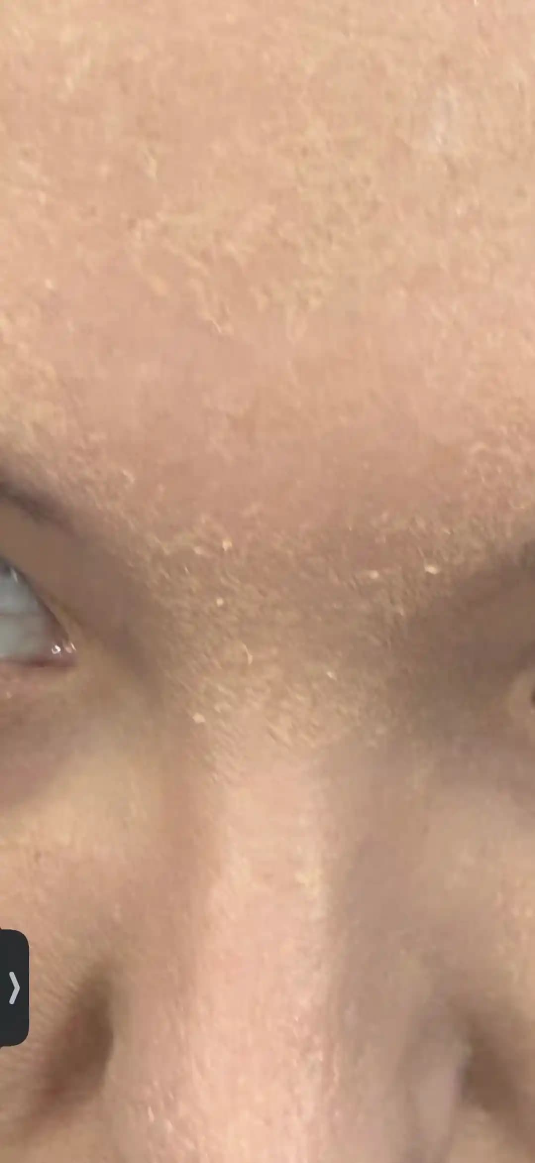 Fondötenin Ciltte Kabuk Kabuk ve Yamalı Görünmesinin Nedenleri ve Çözüm Yöntemleri