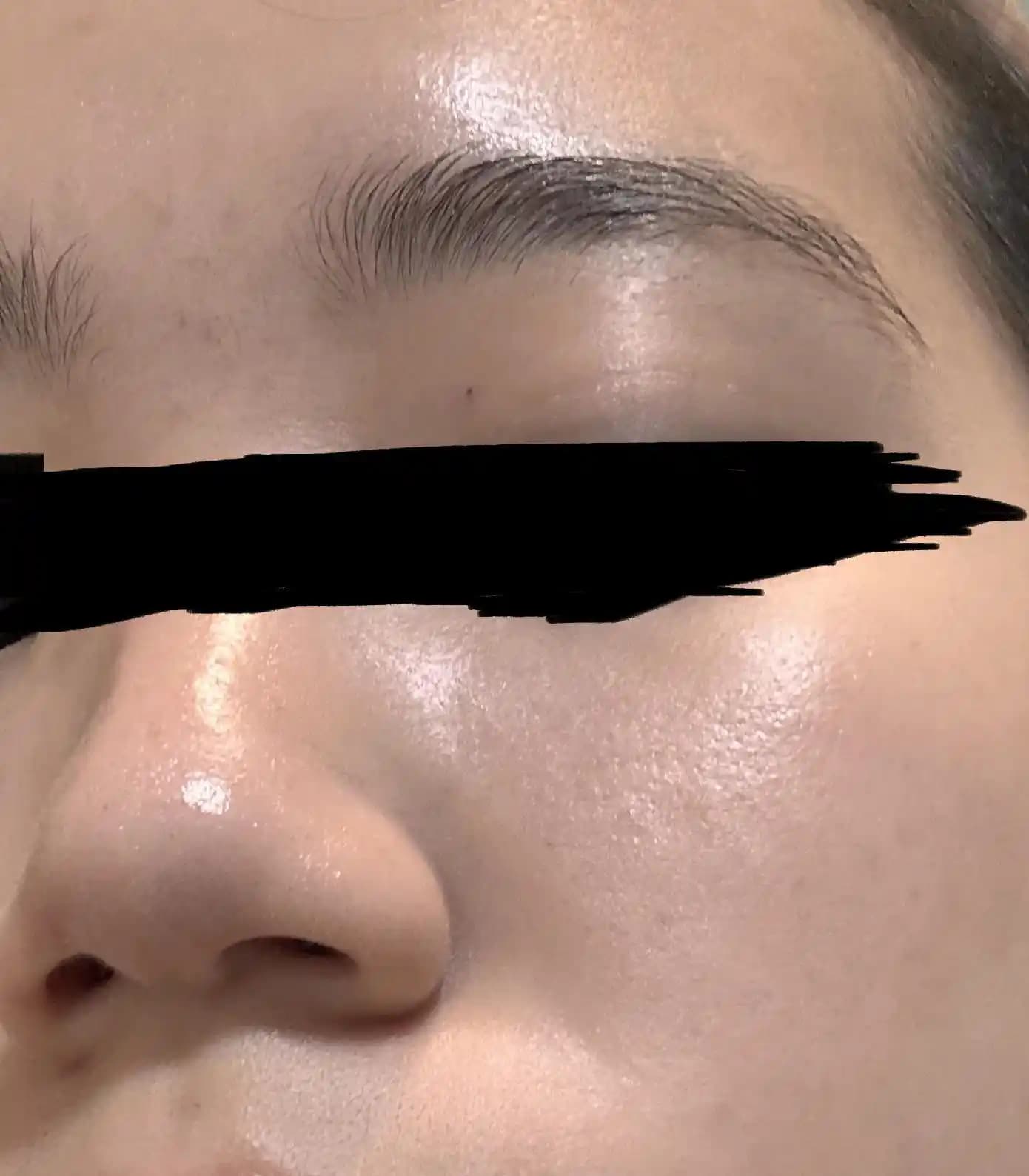 Kapanmış Komedonlar ve Hiperpigmentasyon İçin Etkili Cilt Bakım Ürünleri ve Rutinleri