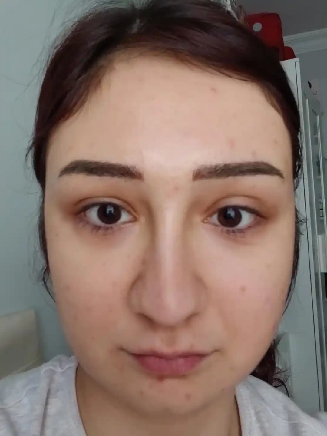 Microblading Sonrası Kaş Şekillendirme ve Altın Oran Uyumunun Önemi